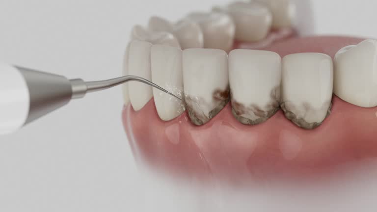 Reliable Dental contractor in Morton, WA by Dentist Open Now